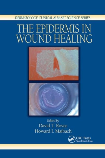 Bilde av The Epidermis In Wound Healing