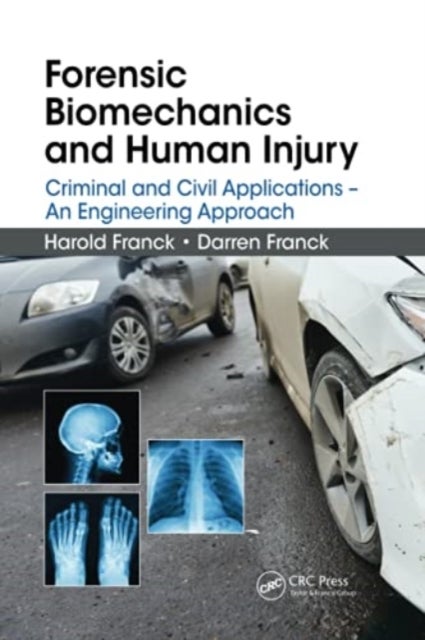 Forensic Biomechanics and Human Injury - Criminal and Civil Applications - An Engineering Approach