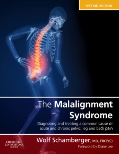 Bilde av The Malalignment Syndrome Av Wolf (clinical Associate Professor Department Of Medicine Division Of Physical Medicine And Rehabilitation And The Allan