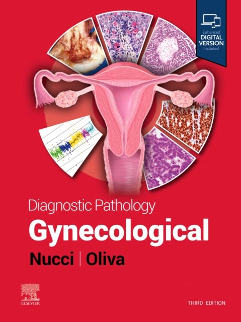 Bilde av Diagnostic Pathology: Gynecological Av Marisa R. (vice Chair And Director Women&#039;s And Perinatal Pathology Department Of Pathology Brigham And Wom