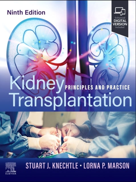 Kidney Transplantation - Principles and Practice