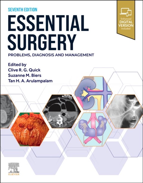 Essential Surgery : Problems, Diagnosis and Manage
