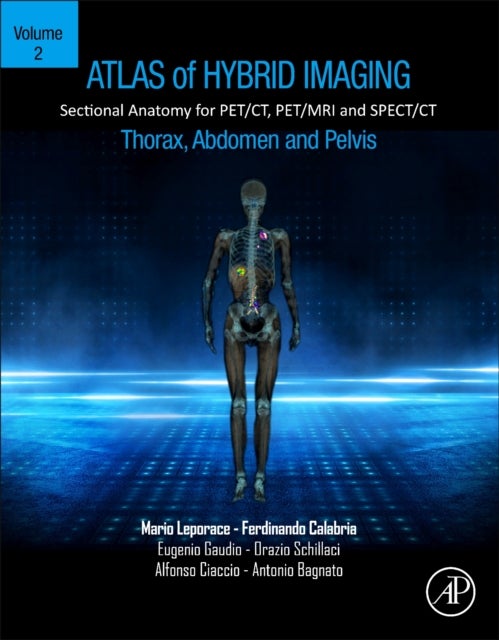 Bilde av Atlas Of Hybrid Imaging Sectional Anatomy For Pet/ct, Pet/mri And Spect/ct Vol. 2: Thorax Abdomen An Av Mario (clinical Radiologist Cosenza Hospital I