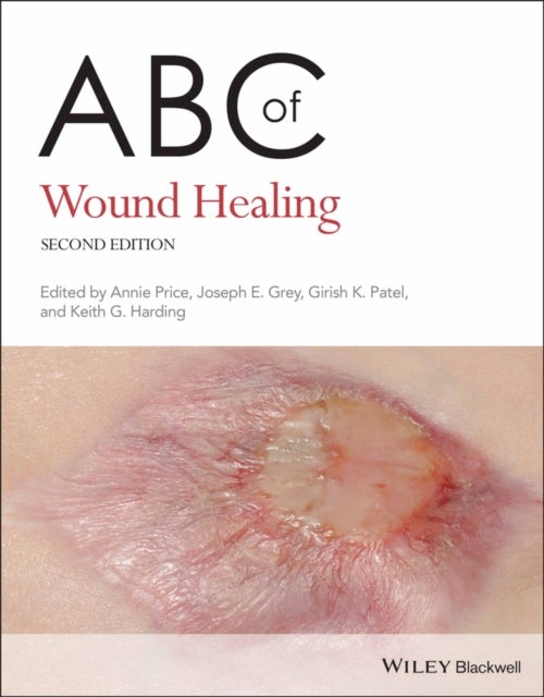 Bilde av Abc Of Wound Healing