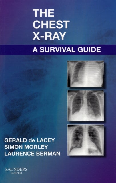 Bilde av The Chest X-ray: A Survival Guide Av Gerald Ma Frcr (consultant Radiologist To Www.radiology-courses.com And Formerly Consultant Radiologist At Northw