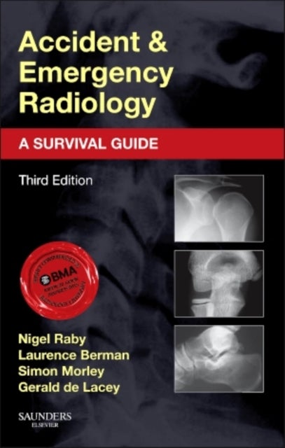 Bilde av Accident And Emergency Radiology: A Survival Guide Av Gerald Ma Frcr (consultant Radiologist To Www.radiology-courses.com And Formerly Consultant Radi