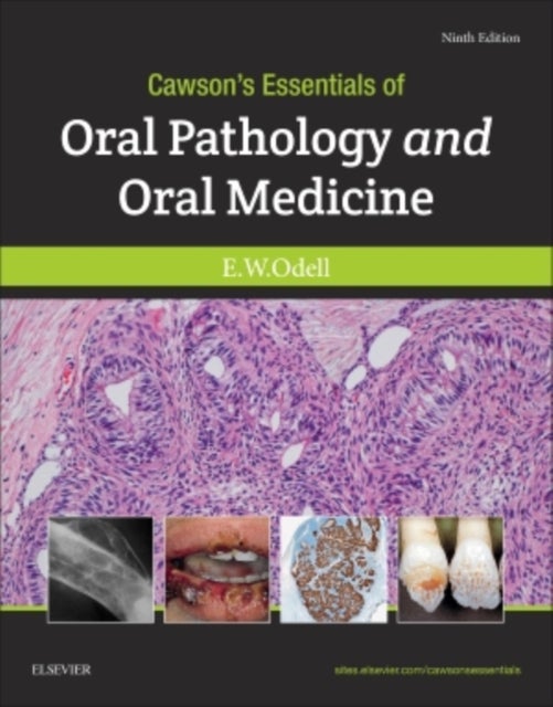 Bilde av Cawson&#039;s Essentials Of Oral Pathology And Oral Medicine Av Edward W Fdsrcs Msc Phd Frcpath (professor Of Oral Pathology And Medicine King&#039;s