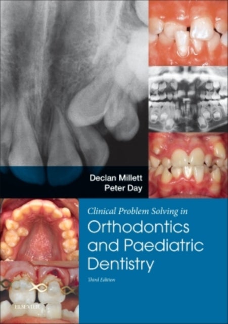 Bilde av Clinical Problem Solving In Dentistry: Orthodontics And Paediatric Dentistry Av Declan Bdsc Dds Fdsrcps Fdsrcs Dorthrcseng Morthrcseng (professor Of O