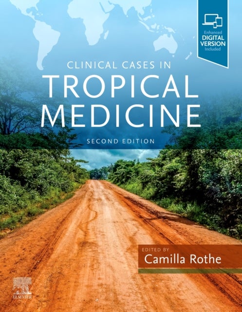 Bilde av Clinical Cases In Tropical Medicine Av Camilla (head Of Clinical Tropical Medicine Division Of Infectious Diseases And Tropical Medicine Lmu Universit