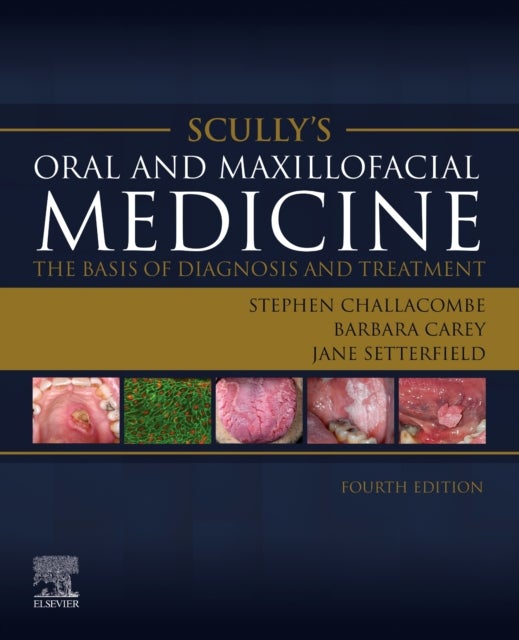 Bilde av Scully&#039;s Oral And Maxillofacial Medicine: The Basis Of Diagnosis And Treatment Av Stephen J. (martin Rushton Professor Of Oral Medicine Centre Fo