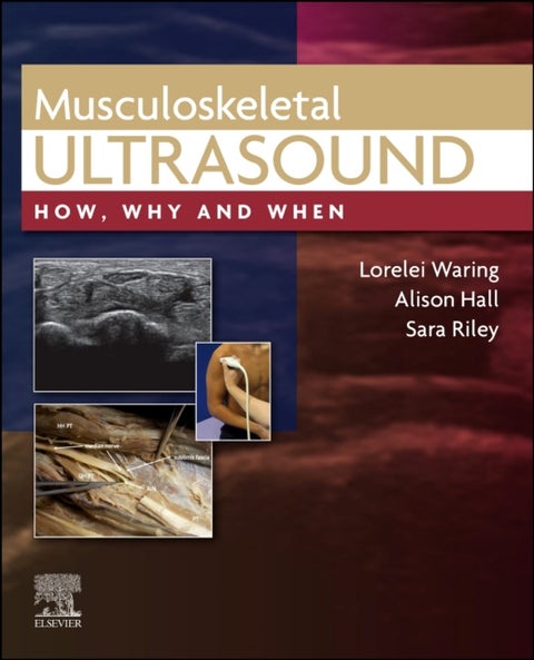 Musculoskeletal Ultrasound - How, Why and When
