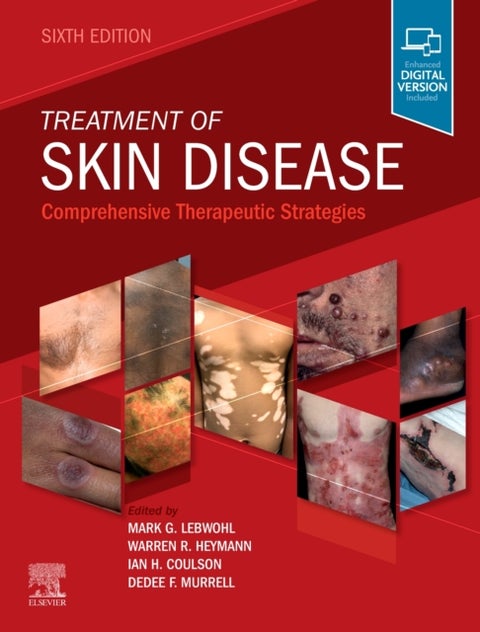 Treatment of Skin Disease - Comprehensive Therapeutic Strategies