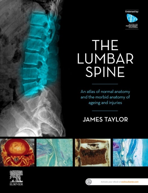 Bilde av The Lumbar Spine Av James Taylor