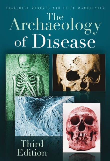 The Archaeology of Disease - Third Edition