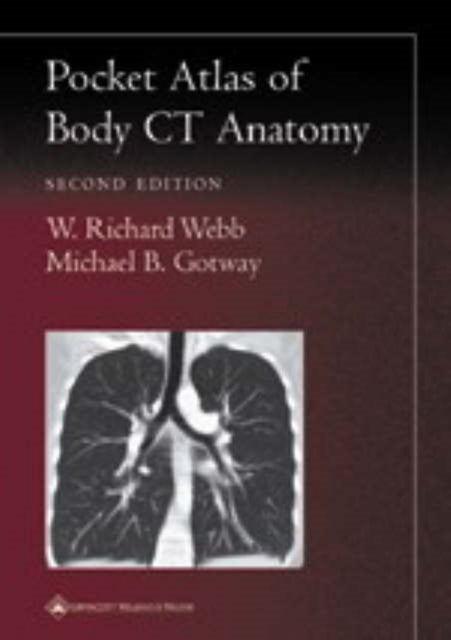 Bilde av Pocket Atlas Of Body Ct Anatomy Av W. Richard Webb, Michael B. Gotway