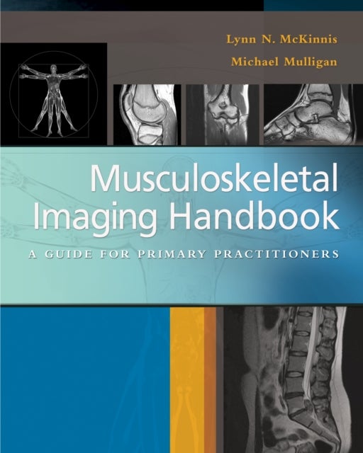 Bilde av Musculoskeletal Imaging Handbook : A Guide For Primary Practitioners Av Mckinnis