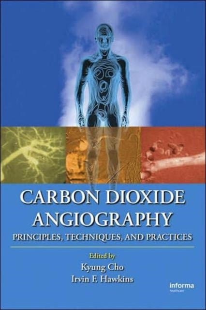 Bilde av Carbon Dioxide Angiography