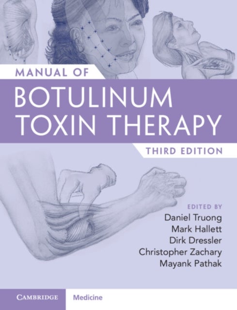 Bilde av Manual Of Botulinum Toxin Therapy