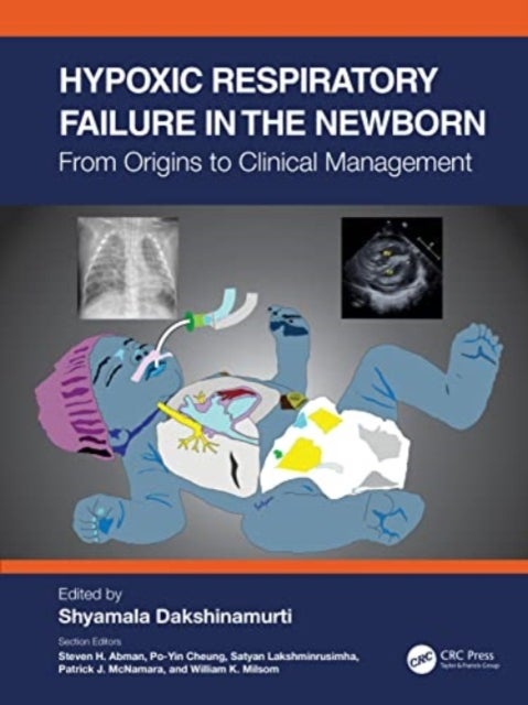 Hypoxic Respiratory Failure in the Newborn - From Origins to Clinical Management