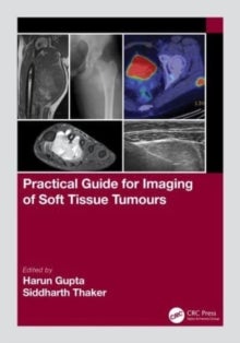 Bilde av Practical Guide For Imaging Of Soft Tissue Tumours