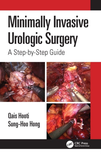 Bilde av Minimally Invasive Urologic Surgery Av Qais Hooti, Sung-hoo Hong