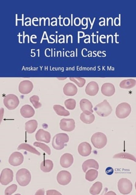 Haematology and the Asian Patient - 51 Clinical Cases