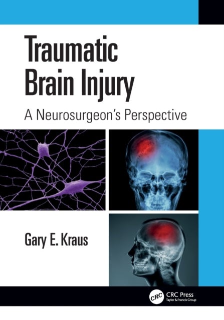 Bilde av Traumatic Brain Injury: A Neurosurgeon&#039;s Perspective Av Gary Kraus