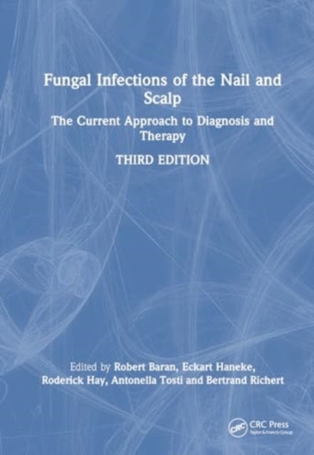 Fungal Infections of the Nail and Scalp - The Current Approach to Diagnosis and Therapy