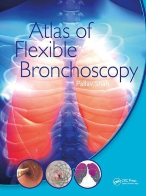 Bilde av Atlas Of Flexible Bronchoscopy Av Pallav (md Mbbs Frcp Consultant Physician Royal Brompton Hospital And Chelsea And Westminster Hospital London Uk) Sh