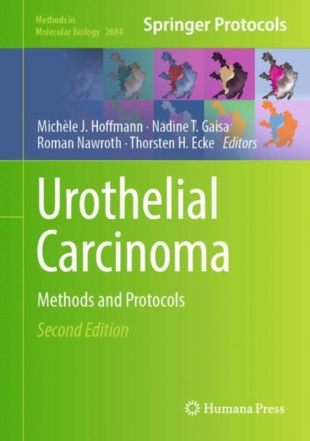 Urothelial Carcinoma - Methods and Protocols