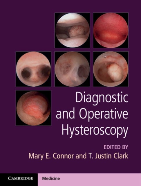 Bilde av Diagnostic And Operative Hysteroscopy