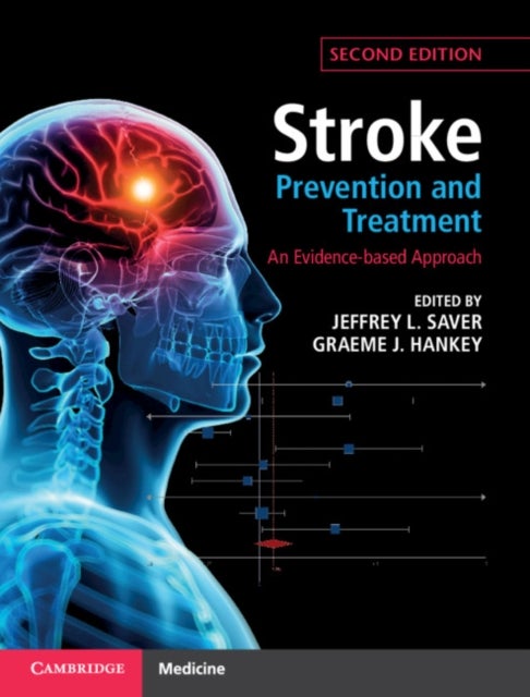 Bilde av Stroke Prevention And Treatment