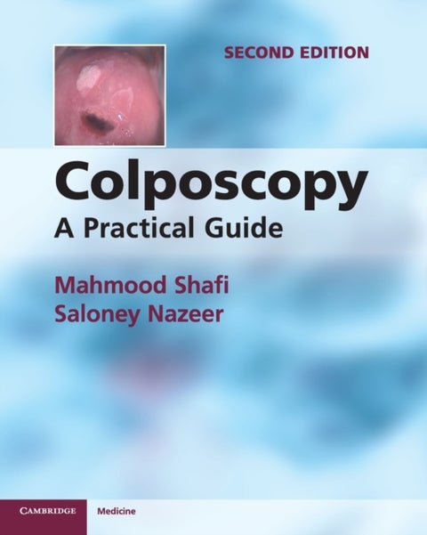 Colposcopy - A Practical Guide