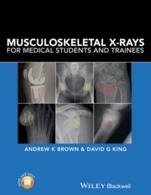 Bilde av Musculoskeletal X-rays For Medical Students And Trainees Av Andrew (consultant Rheumatologist And Senior Lecturer In Medical Education Hull York Medic