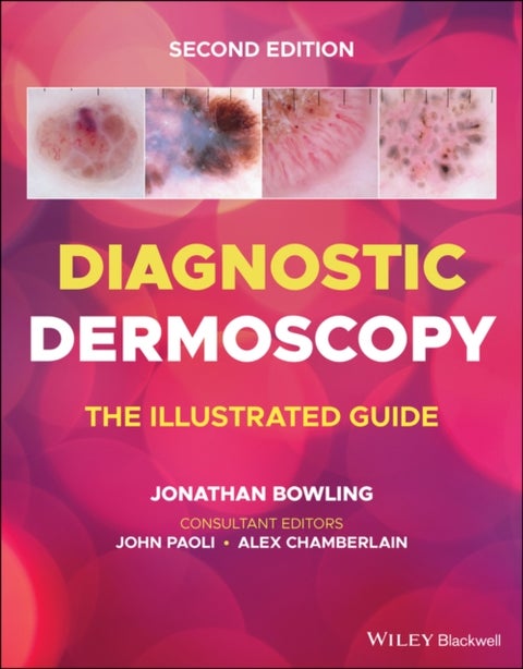 Diagnostic Dermoscopy - The Illustrated Guide