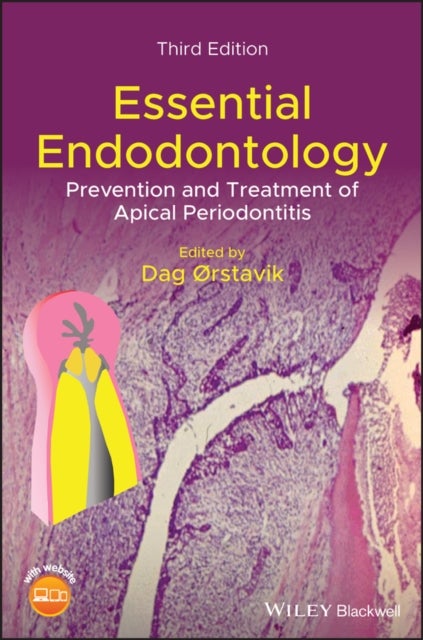 Essential Endodontology - Prevention and Treatment of Apical Periodontitis