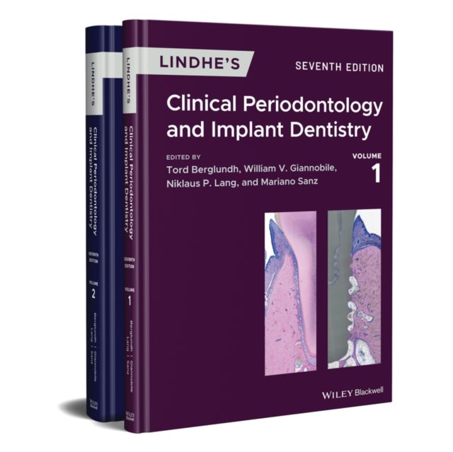 Bilde av Lindhe&#039;s Clinical Periodontology And Implant Dentistry, 2 Volume Set