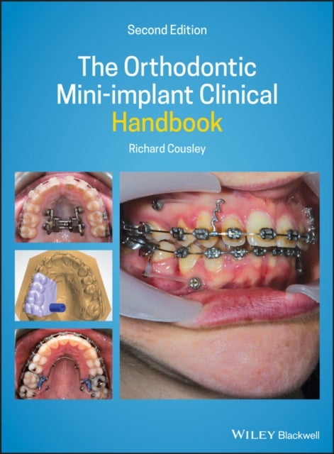 Bilde av The Orthodontic Mini-implant Clinical Handbook Av Richard (consultant Orthodontist For The Peterborough &amp; Stamford Hospitals Nhs Foundation Trust)