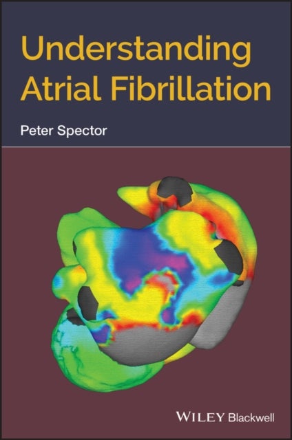 Bilde av Understanding Atrial Fibrillation Av Peter (professor Of Medicine Director Cardiac Electrophysiology And Cardiac Electrophysiology Laboratory Universi