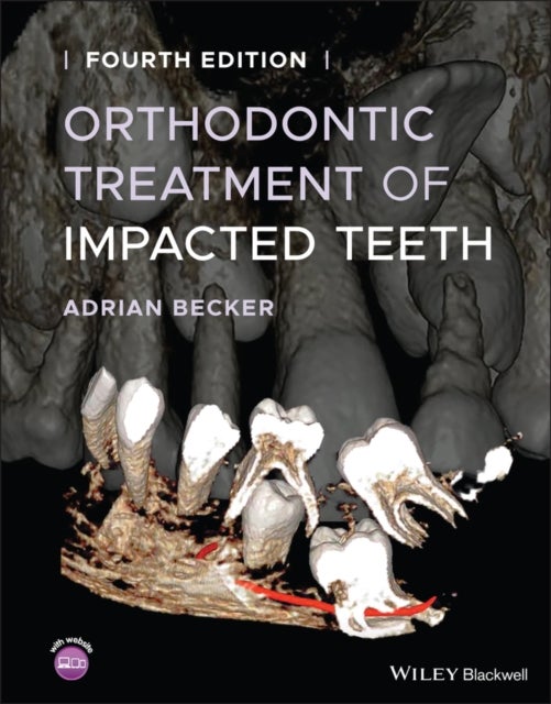 Bilde av Orthodontic Treatment Of Impacted Teeth Av Adrian (department Of Orthodontics At The Hebrew University-hadassah School Of Dental Medicine Jerusalem) B