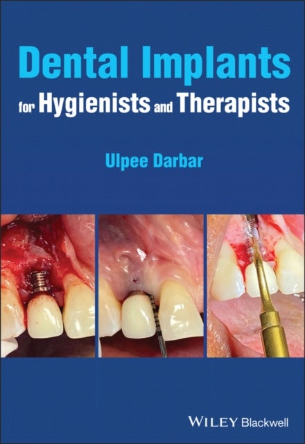 Bilde av Dental Implants For Hygienists And Therapists Av Ulpee R. (eastman Dental Hospital London Uk) Darbar