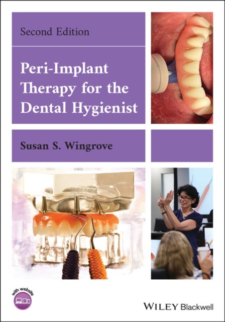 Bilde av Peri-implant Therapy For The Dental Hygienist Av Susan S. (the Implant Consortium Missoula Mt) Wingrove