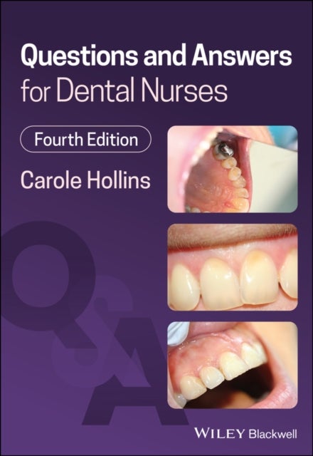 Bilde av Questions And Answers For Dental Nurses Av Carole (british Dental Association) Hollins