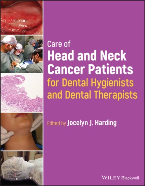 Bilde av Care Of Head And Neck Cancer Patients For Dental Hygienists And Dental Therapists