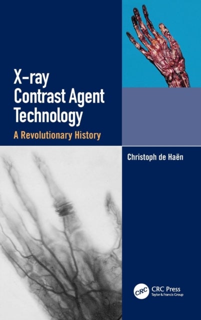 Bilde av X-ray Contrast Agent Technology Av Christoph (bracco Imaging Spa (retired) University Of Washington (retired)) De Haen