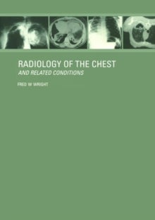 Radiology of the Chest and Related Conditions - Together with an extensive illustrative collection of radiographs, conventional and computed tomogra