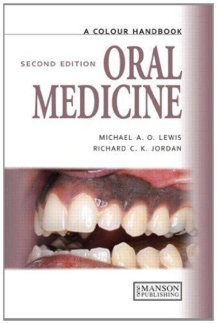 Bilde av Oral Medicine Av Michael (university Of Central Lancashire Uk) Lewis, Richard Jordan