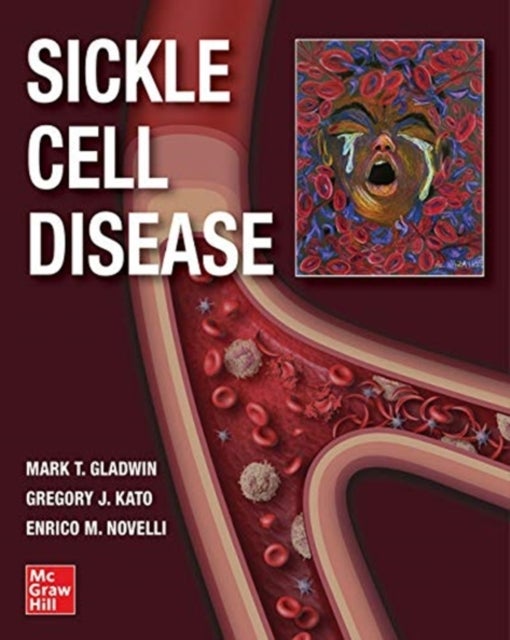 Bilde av Sickle Cell Disease Av Mark T. Gladwin, Gregory J. Kato, Gregory Kato, Enrico M. Novelli