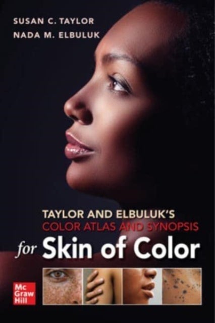 Bilde av Taylor And Elbuluk&#039;s Color Atlas And Synopsis For Skin Of Color Av Susan Taylor, Nada Elbuluk