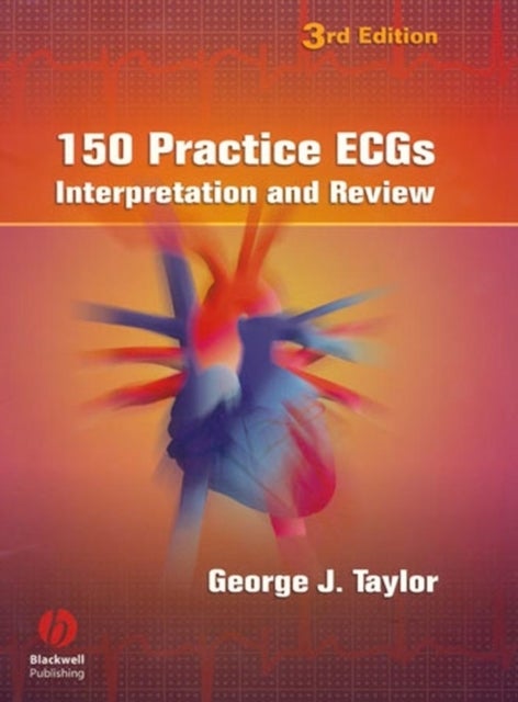 Bilde av 150 Practice Ecgs - Interpretation And Review 3e Av Gj Taylor